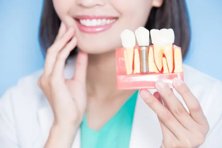 Implante dentário em Manaus — Sanmede Clínica Odontológica