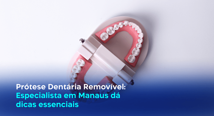prótese dentária removível