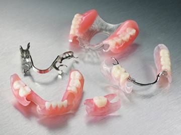 foto de protese dentaria removivel com grampo