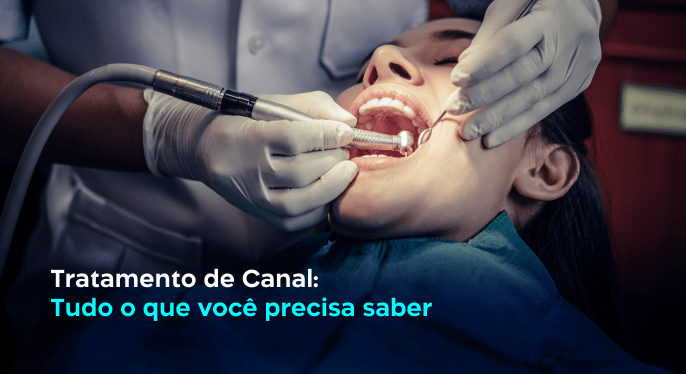 tratamento-de-canal-