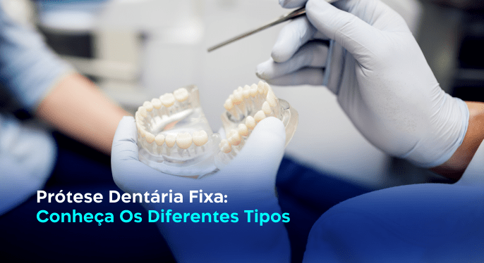 Prótese Dentária Fixa