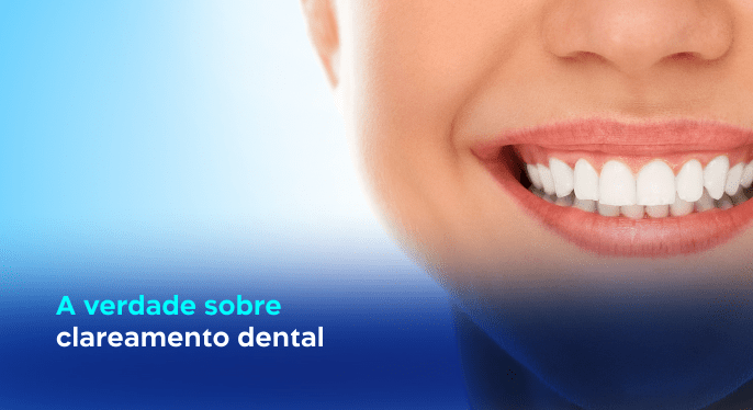 Clareamento dentário