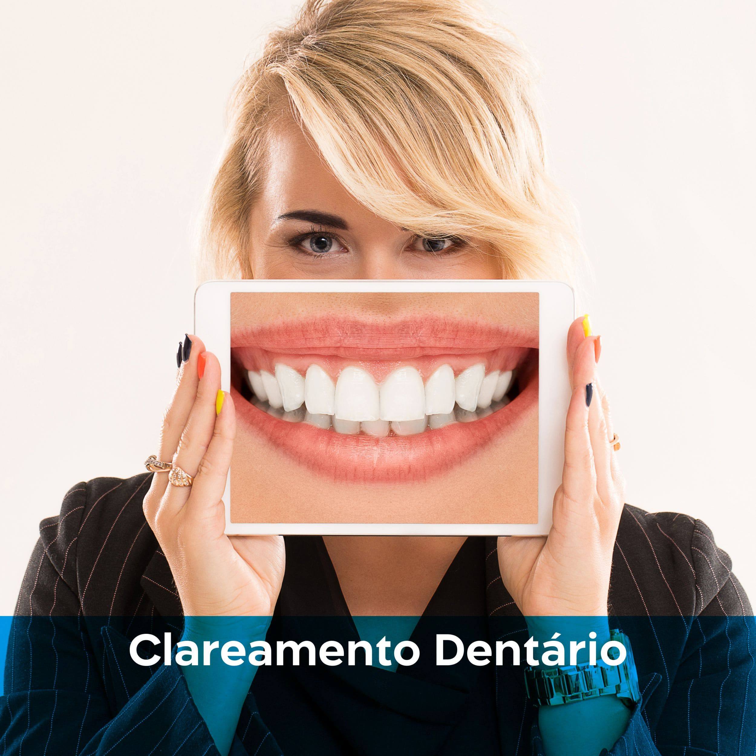 clareamento-dentário-em-Manaus