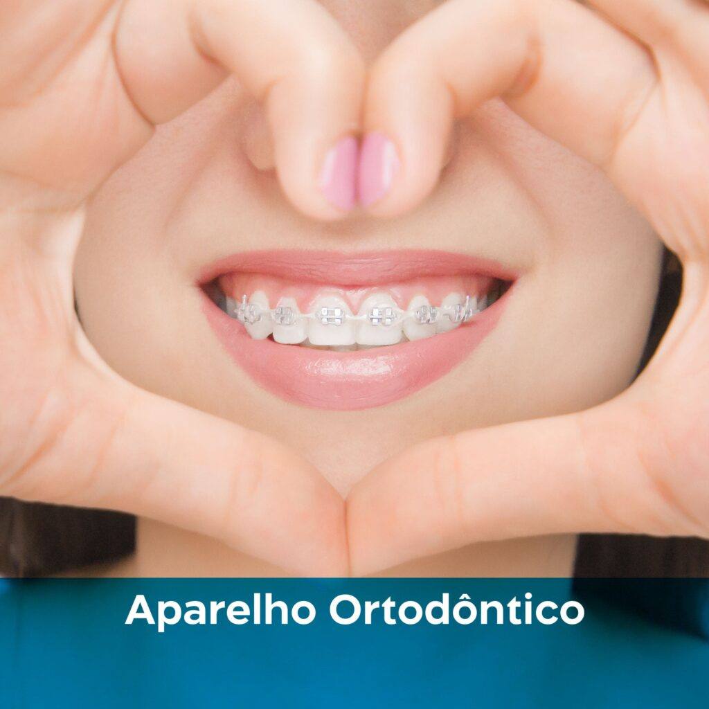 aparelho-ortodôntico-manaus-dentista